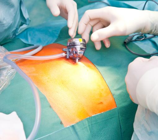 minimally invasive spine surgery