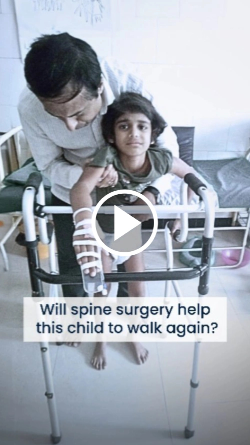 will spine surgery help this child to walk again How Does Spinal Fusion Help In Relieving Back Pain?