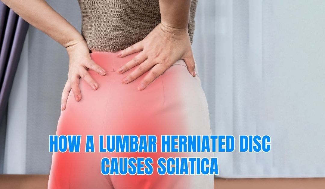 How a Lumbar Herniated Disc Causes Sciatica?