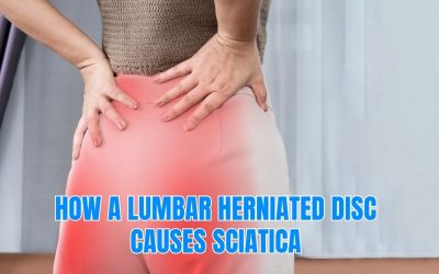 How a Lumbar Herniated Disc Causes Sciatica?