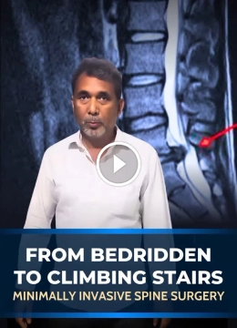 from bedridden to climbing stairs Dr. Nandan Marathe