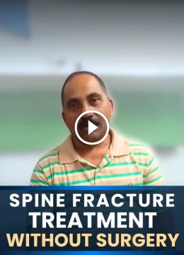 Spine fracture treatment without surgery