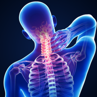 Spondylosis / Neck Pain