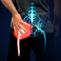Sciatica