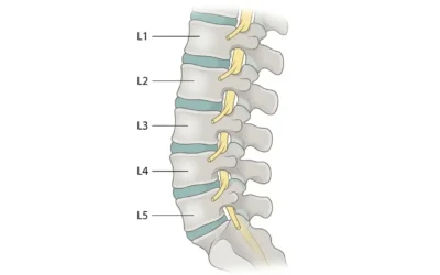 When A Spinal Bone Slips Forward